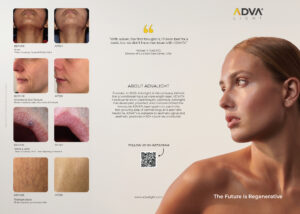 Advatx Patient Brochure